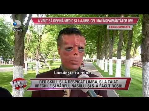 WOWBIZ (29.05.2017) - Red Skull si-a despicat limba, si-a taiat urechile si s-a facut rosu!