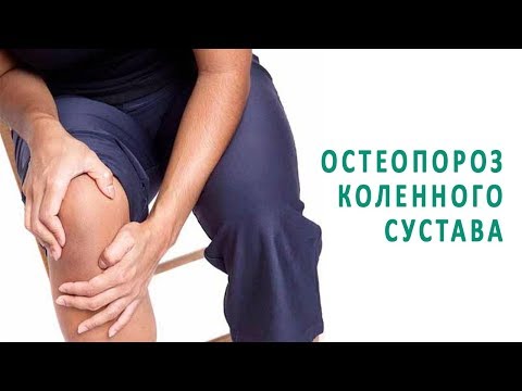 Остеопороз коленного сустава и его лечение