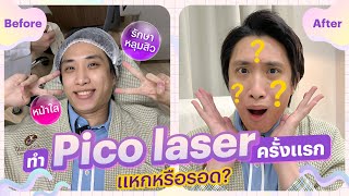 ทำ Pico Laser ครั้งแรก 2 โหมดจุกๆ จะแหกหรือรอด?​ | Timeless Laser Clinic | Vlog Ep.4