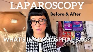 LAPAROSCOPY SURGERY (BEFORE & AFTER)  WHAT'S IN MY HOSPITAL BAG? + RECOVERY TIPS | CLARA SALGUEIRO