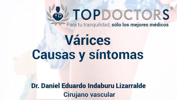 varicose sabablari