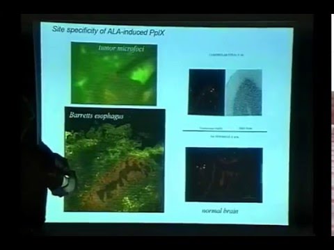 Photodynamic Therapy Fundamentals - Prof. Dr. Brian C. Wilson photodynamic therapy eye