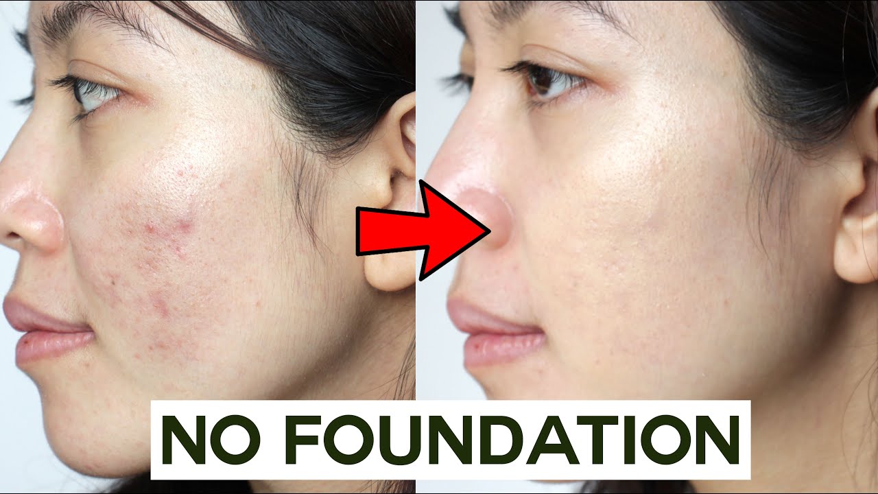 How to Cover & Blemishes WITHOUT Foundation • & non cakey - YouTube