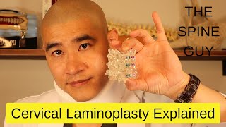 Cervical Laminoplasty Explained