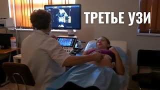 Третий триместр беременности | Узи в 27 недель у Черногуз | Игра в D&D | Вяленые помидоры