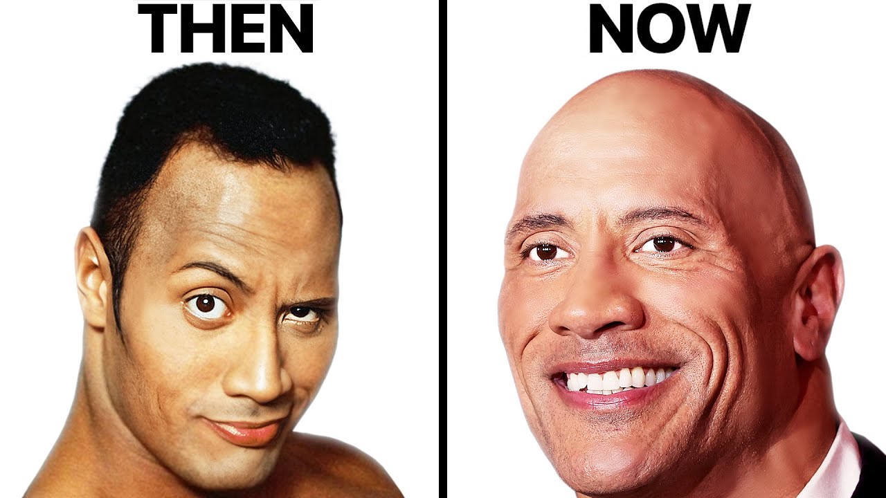 The Rock Hair Loss Analysis | Is Bald The Answer?
