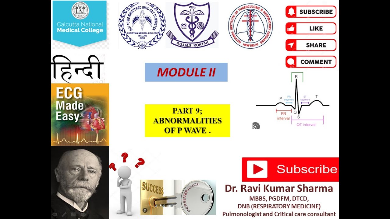 ECG made Easy(हिन्दी): PART 9; P wave abnormalities - YouTube