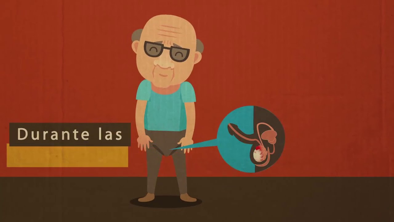 Acciones del Instituto Nacional de Cancerología·#3 video to gif
