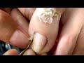 How to Repair Nails easy # 432 - Xuyen Nail