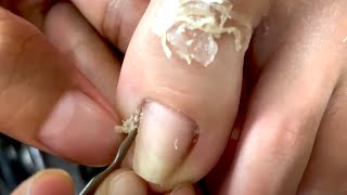 How to Repair Nails easy # 432 - Xuyen Nail