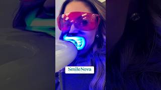 Teeth whitening in Gilbert save $50 mention Jules  teethwhitening