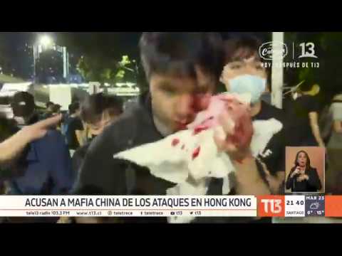 Vídeo: Balas Y Palillos De Dientes: Dentro De La Escena De Los Juegos De Hong Kong