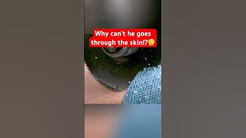 Why Doesn’t a Cast Saw Cut Through Skin?