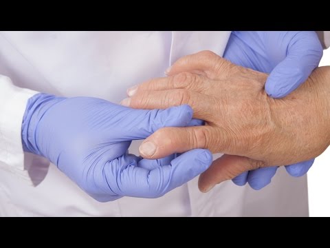 Video: ¿Cuándo empeora el dolor de la artritis?