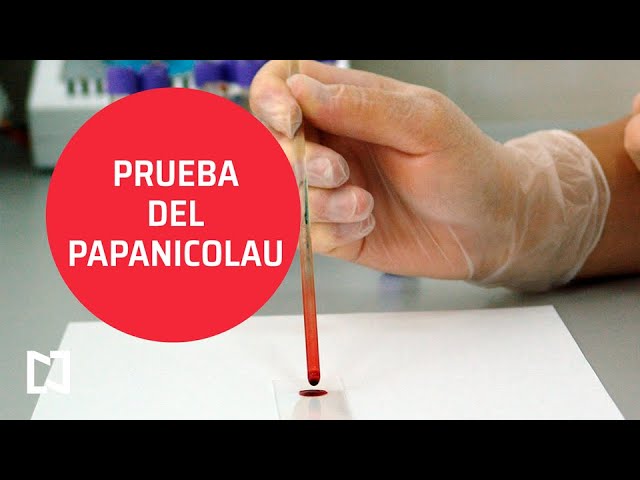 cómo se hace el papanicolau video cómo se hace el papanicolau video