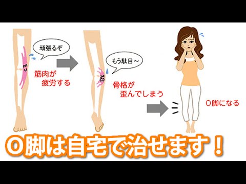 福辻式 ｏ脚矯正プログラム 自分でｏ脚を短期間で治す方法 Youtube