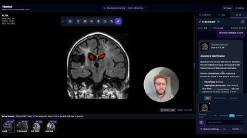 VibeRad: Reimagining Radiology Education with Gemini 3 Pro