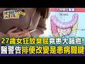 27歲女「瘋狂放臭屁」驗出大腸癌三期崩潰！「排便改變」醫警告是患病關鍵【東森醫起看】  @57healthy ​
