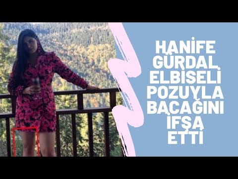 Hanife Gürdal mini elbiseli pozuyla bacağını ifşa etti fotoğrafı apar topar kaldırdı