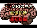 CT.MRIの見方！画像診断、超初級編