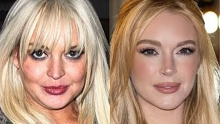 Lindsay Lohan Is Unrecognizable After $300K Face Lift Wealth