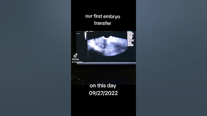 our first embryo transfer #pregnancy #surrogacy #surrogate #ivf #surrogacyjourney #surrogatemother