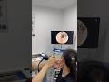 Huge Earwax Plug Pulled Out 😨 | Satisfying ENT Ear Cleaning #EarCare #ENT #Shorts