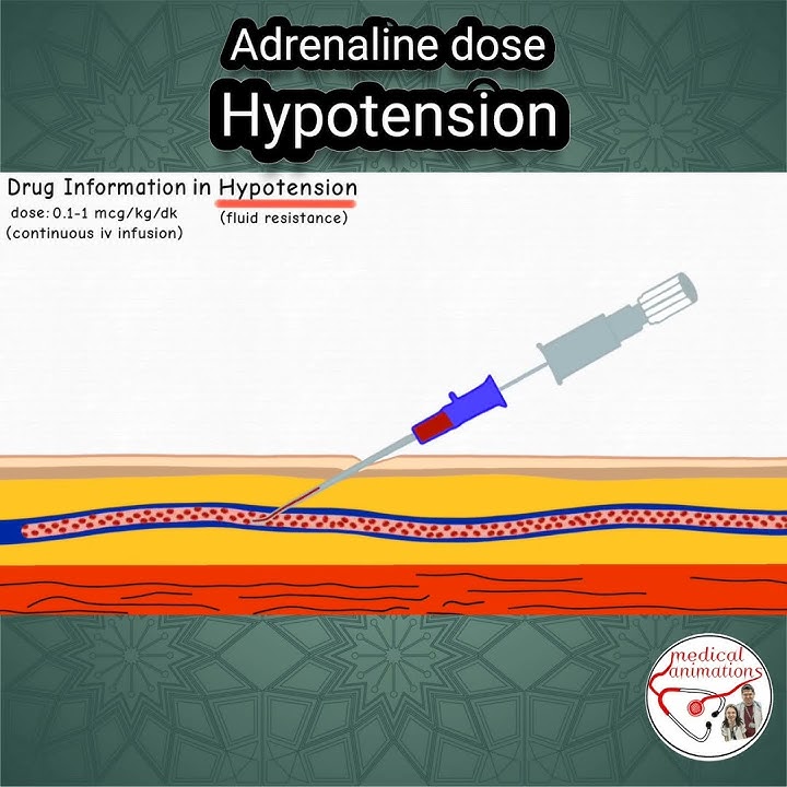ADRENALINE (Epinephrine) DOSE in HYPOTENSION #pediatrics #medicine #epinephrine