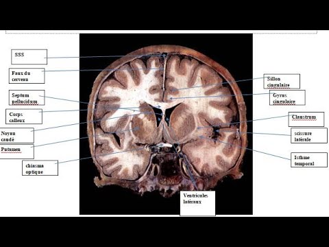 Anatomie topographique du cerveau - coupes frontales sériées