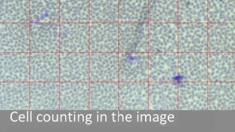 Grid projection Software Free with all Imaging Modules