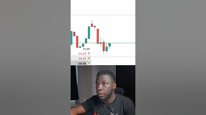 Why You Should Be A Scalper | Live Forex Trading