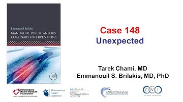 Case 148: PCI Manual - Unexpected