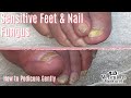 👣How to Pedicure on Elderly Toenails Gentle Cleaning👣