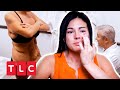 Angel hat zu viel Haut am Körper | Raus aus meiner Haut | TLC Deutschland