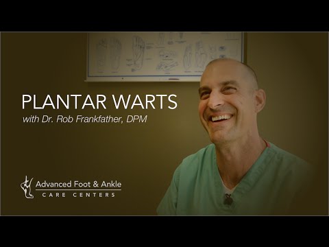 Plantar Warts - What They Are & How To Remove Them