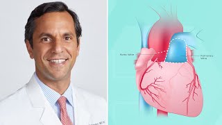 Research Alert: Ross Procedure Leads to Improved Survival Benefit for Aortic Valve Patients