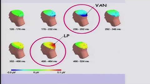 2014 TSC  Plenary 5   Brain networks and consciousness 360p