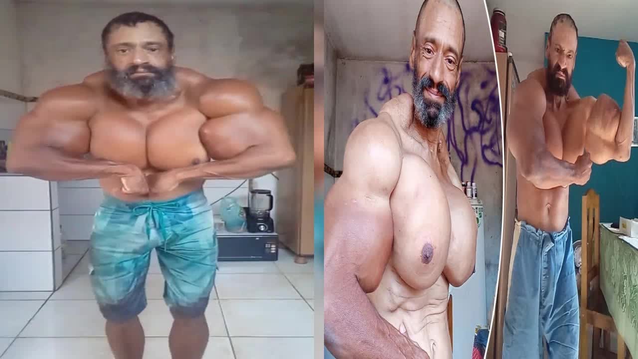 Synthol Man Dies