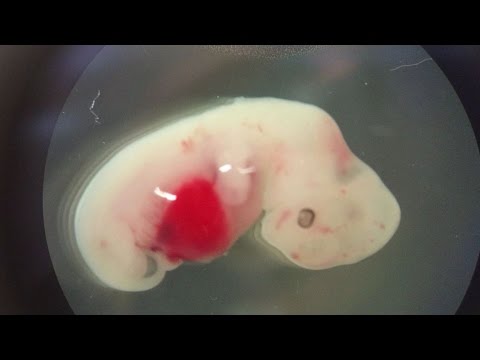 #Cსტუდია - მეცნიერებმა ადამანისა და ღორის ჰიბრიდი ემბრიონი შექმნეს