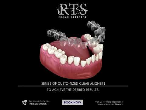 Route To Smile Clear Aligners - Social Media Marketing (SMM) in India | Promotional Videos in India