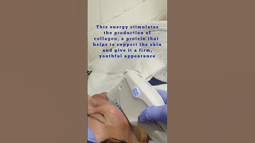 Ultherapy Non Surgical Face Lift| Ulthera Facelifting| HIFU Face Tight Mumbai India| Debraj Shome