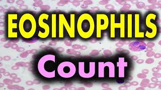 Eosinophils high in blood test means