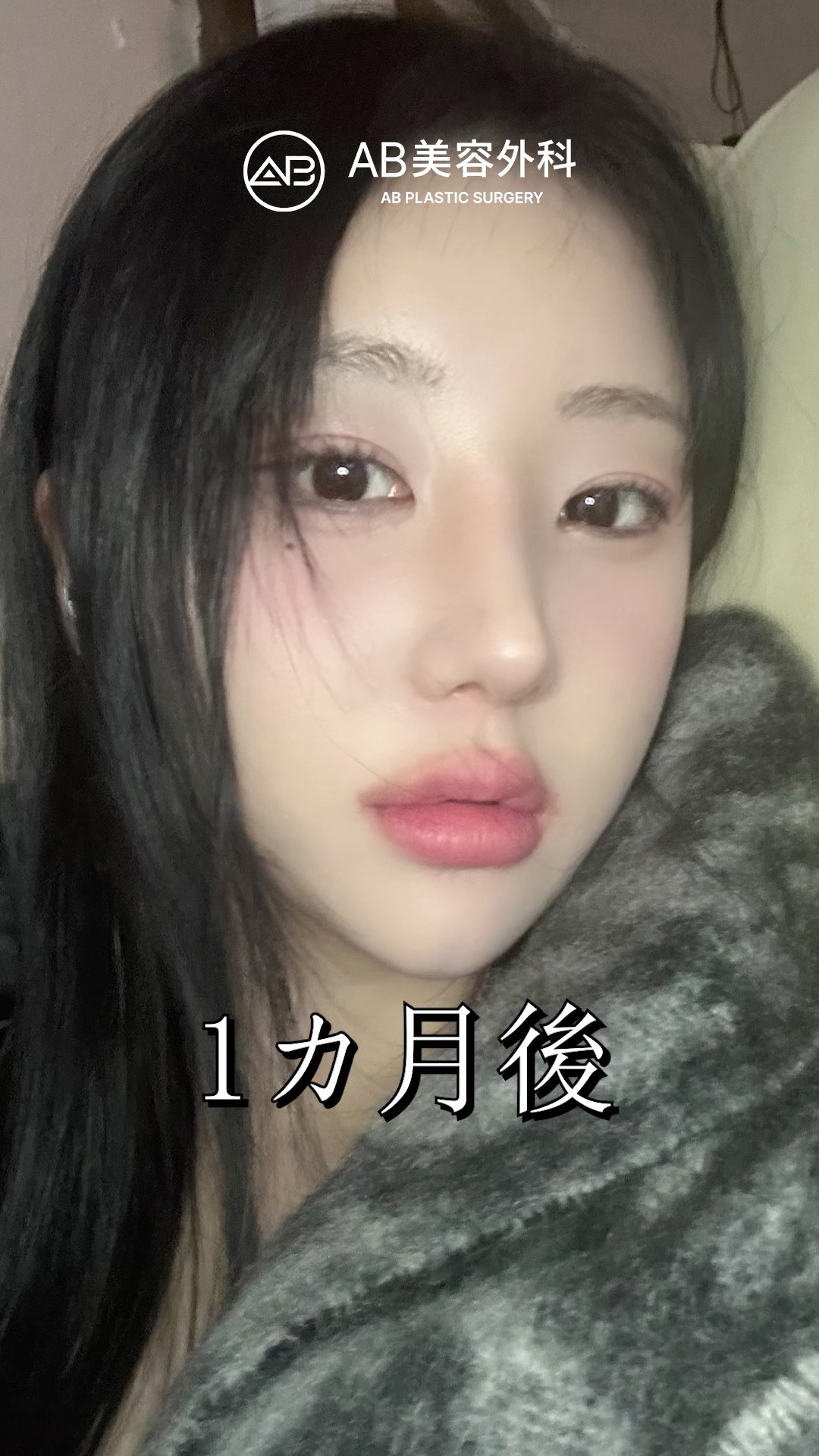 整形後の雰囲気、まるでアイドル級… #shorts