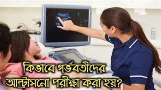 কিভাবে গর্ভবতীদের আল্ট্রাসনো পরীক্ষা করা হয়? জানুন | ultrasonography in pregnancy bangla.