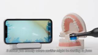 SeeBrush: built-in 1 million megapixel camera to immediately understand your current oral condition