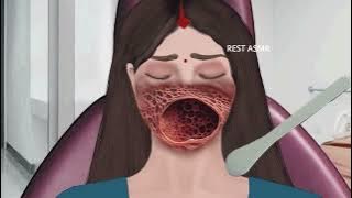 ASMR Animation treatment from infected mouth | 2D Animation @restasmr1