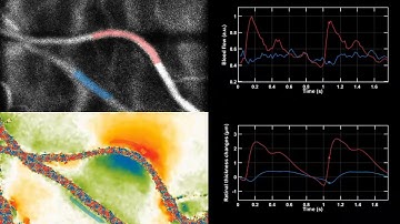 Human retinal blood flow imaged with OCT and Doppler holography #Shorts