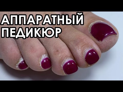 АППАРАТНЫЙ ПЕДИКЮР! ОБРАБОТКА ПАЛЬЧИКОВ!