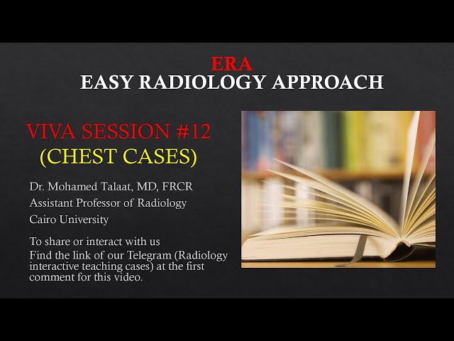 Viva session #12 (Chest cases-consolidation 1st part)
