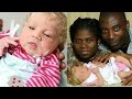 أبوان أسودان ينجبان طفلة شقاء ذات عيون زرقاء قصة وعبرة